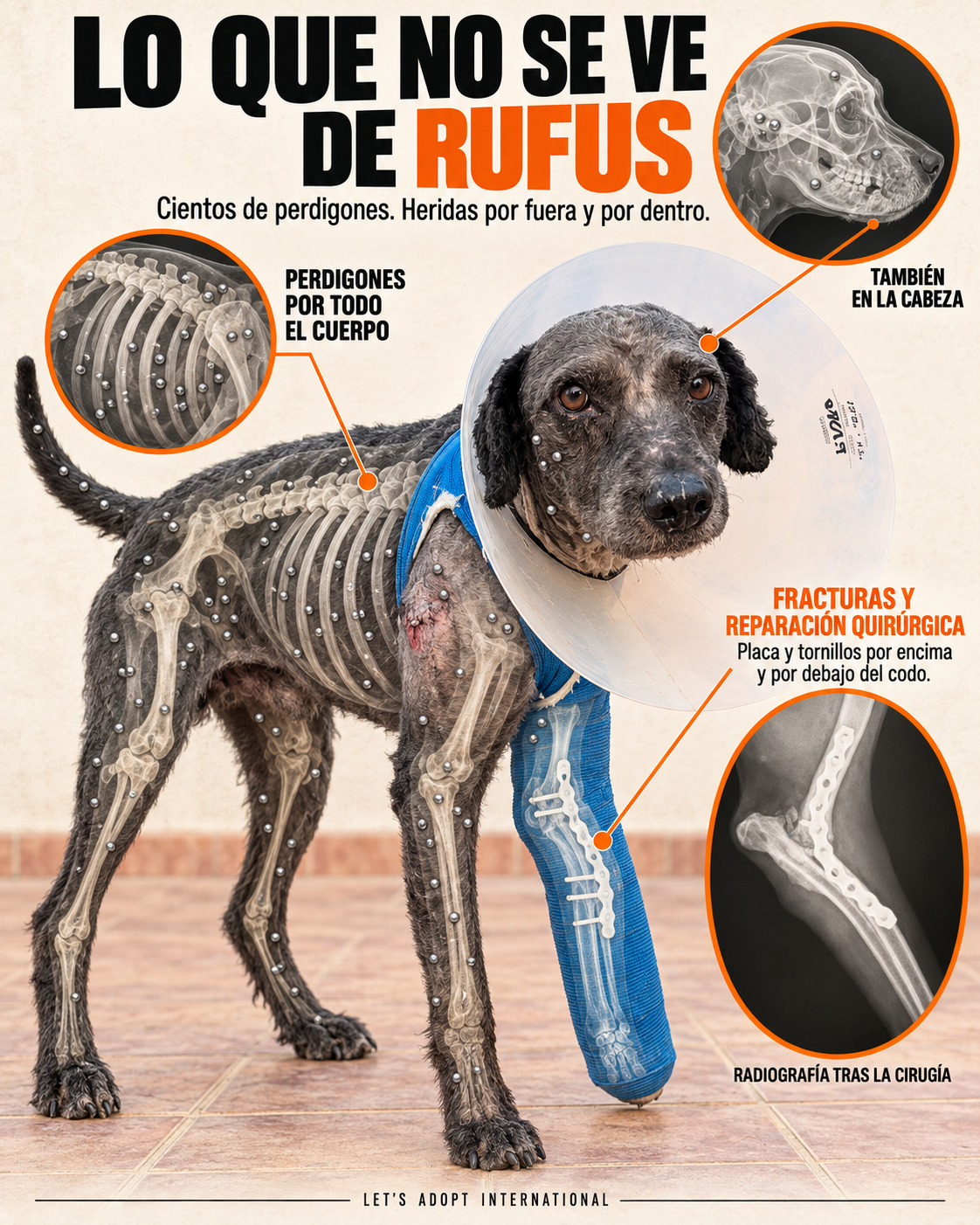 Infografía de Rufus con una representación aproximada de los perdigones y la reparación del codo.